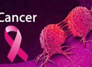 Understanding Prostate Cancer: Silent Battle – Easy Health Tips understanding-prostate-cancer-silent-battle-easy-health-tips