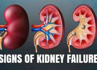 Signs of Kidney Dysfunction: Spotting Symptoms for Early Detection signs-of-kidney-dysfunction-spotting-symptoms-for-early-detection