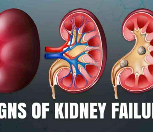 Signs of Kidney Dysfunction: Spotting Symptoms for Early Detection signs-of-kidney-dysfunction-spotting-symptoms-for-early-detection